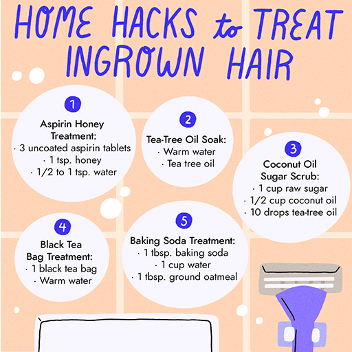Ingrown hair Treatment and prevention