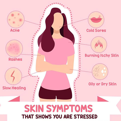 How to Deal with Stressed Skin - Eshaistic Blog