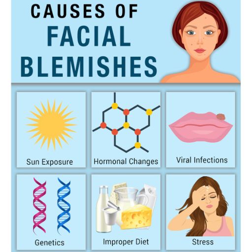 causes of facial blemishes