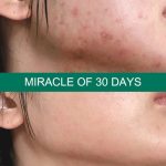 Some By Mi - AHA BHA PHA 30 Days Miracle Truecica Clear Pad - Image 2