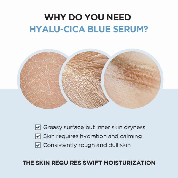 Skin1004 - Madagascar Centella Hyalu-Cica Blue Serum - 50ml - Image 3