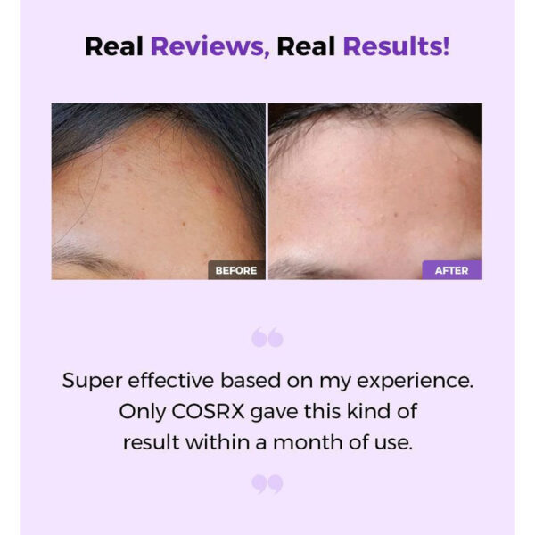 Cosrx AHA/BHA Clarifying Treatment Toner – 100ml - Image 2