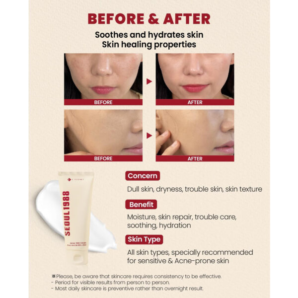 K-Secret Seoul 1988 Cream : Snail Mucin 93% + Rice 100ml - Image 3